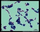 Staphylococcus and Klebsiella